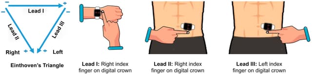Comment utiliser l'Apple Watch pour effectuer un ECG plus précis
