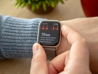 L'Apple Watch est capable de vous empêcher de faire des cauchemars…